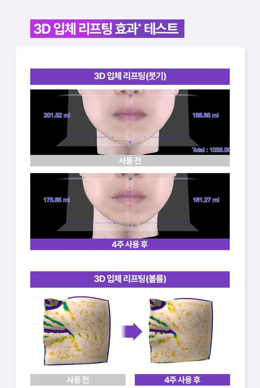 [쫀쫀탄력|속보습] 바이오힐 보 프로바이오덤 3D 리프팅 앰플 30ml [단품/증정기획] 상세페이지 14
